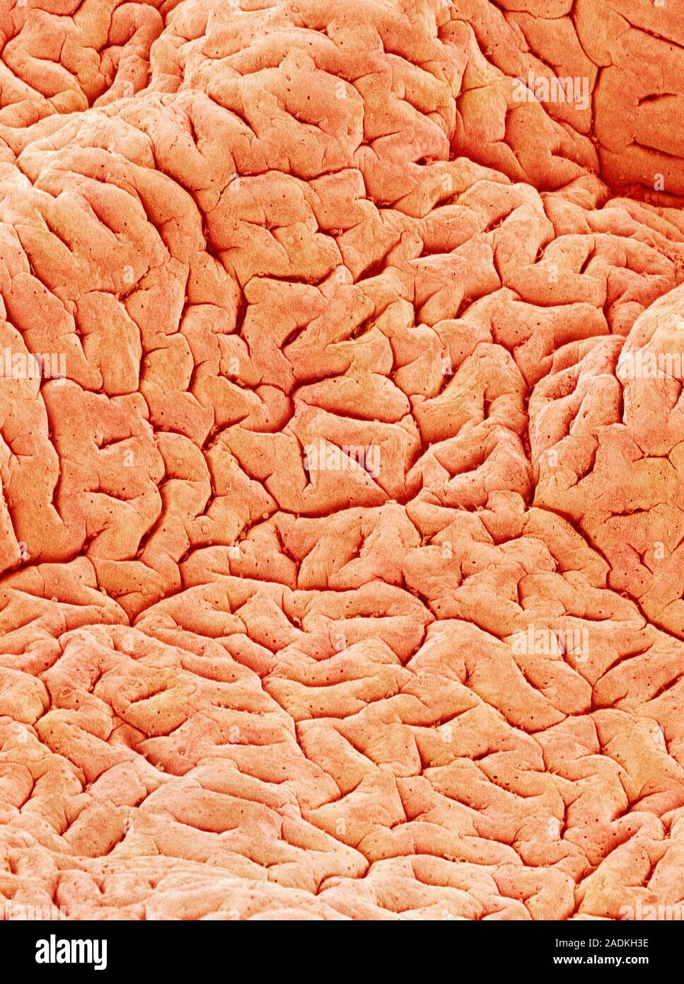 Mucous membrane. Coloured scanning electron micrograph (SEM) of the ...