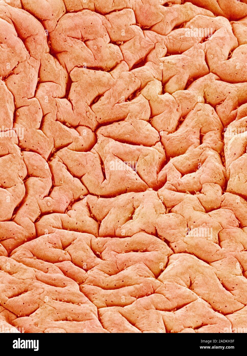 Mucous membrane. Coloured scanning electron micrograph (SEM) of the ...