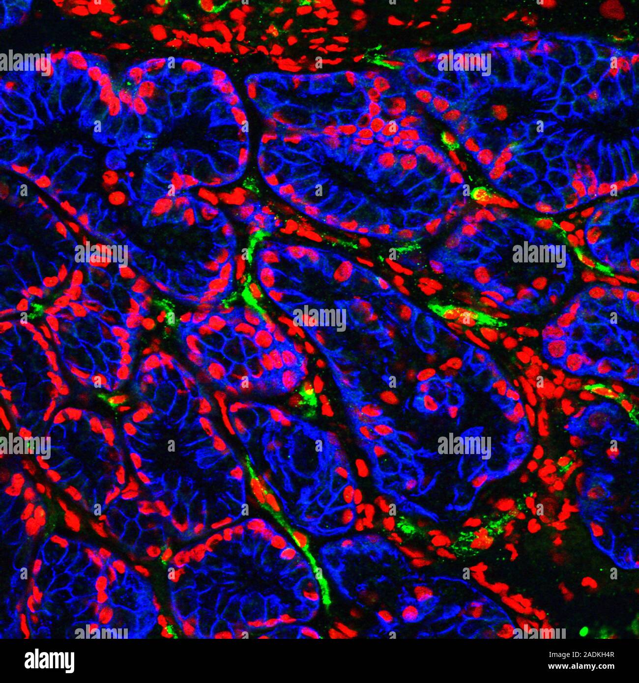 Brunner's glands. Fluorescence confocal light micrograph of a section
