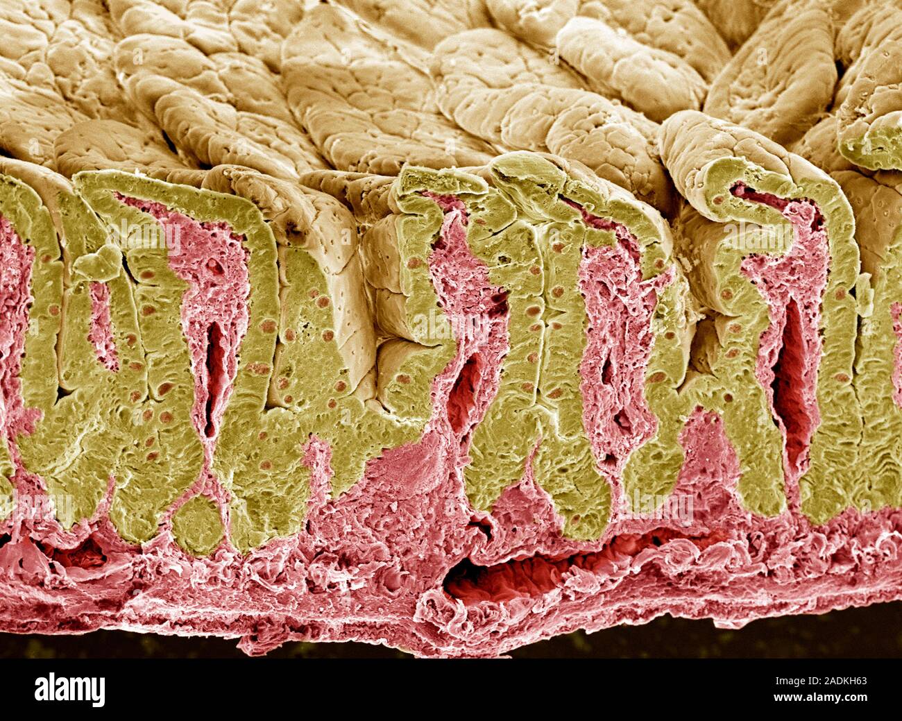 Внутренняя поверхность кишечника. Кишечная Ворсинка гистология. Кишечные ворсинки микрофотография. Кишечник под микроскопом. Тонкий кишечник под микроскопом.