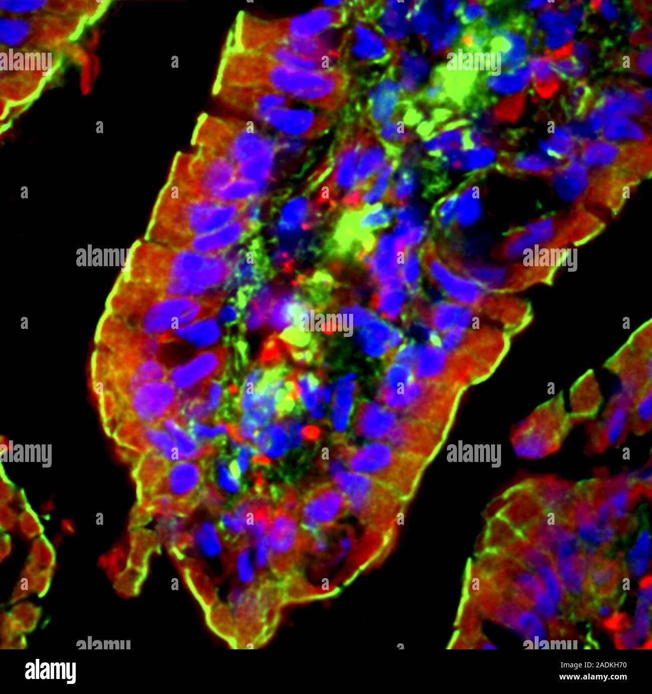 Small intestine villus, fluorescence deconvolution micrograph ...