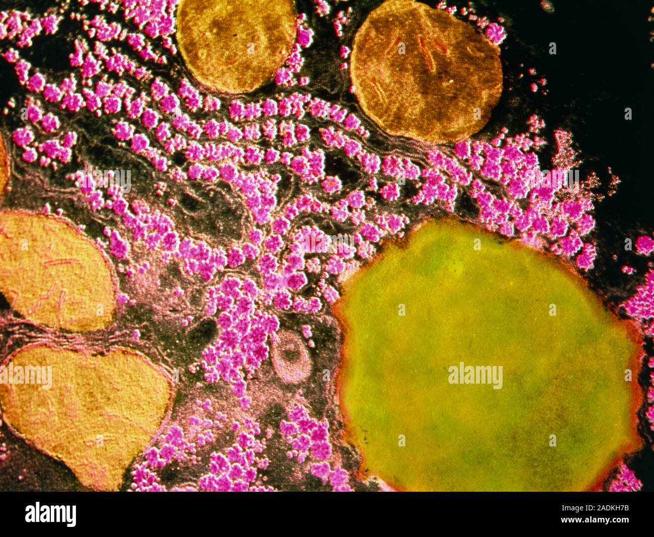 False colour transmission electron micrograph (TEM) of a section ...