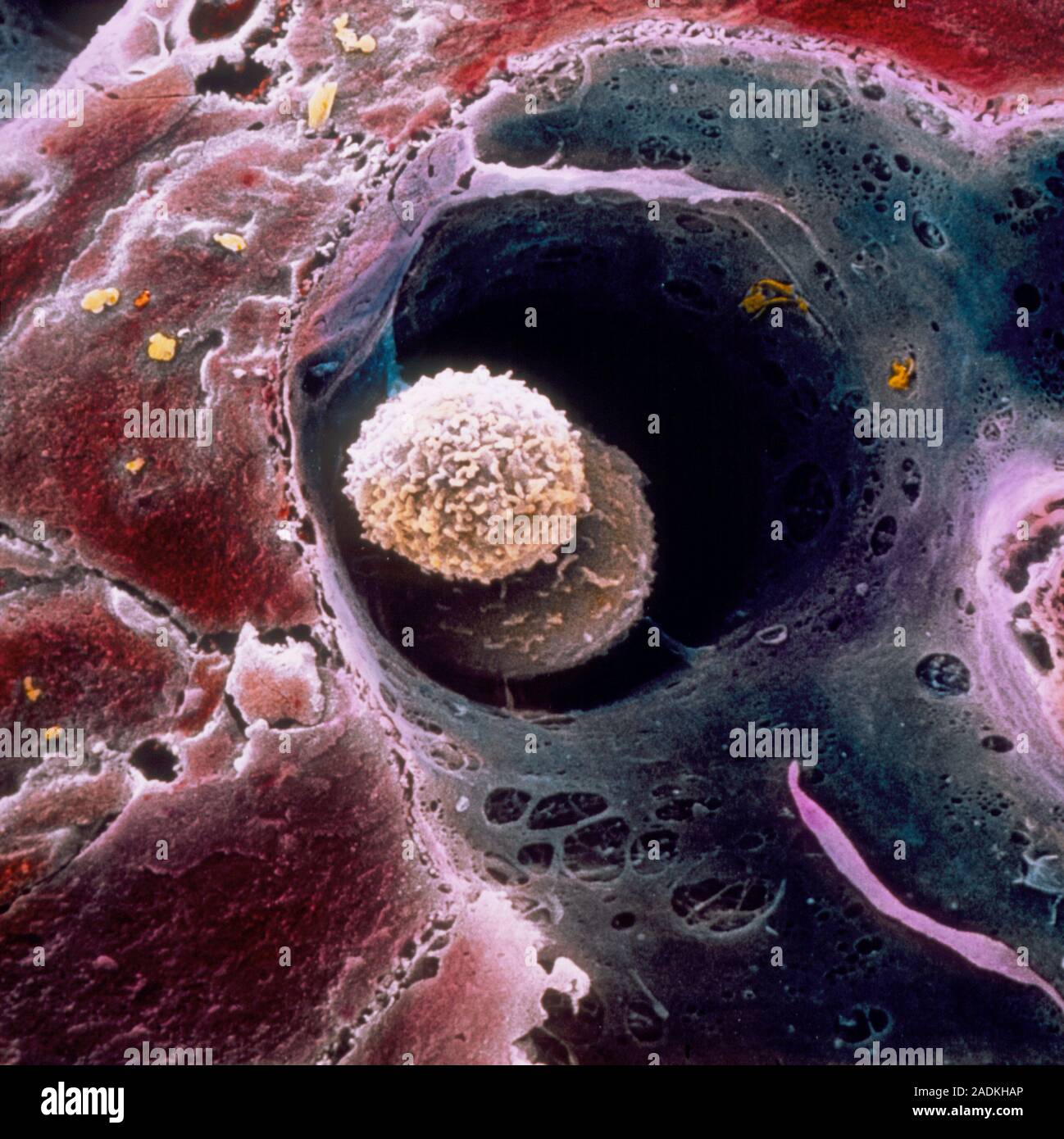 Liver tissue. False-colour scanning electron micrograph (SEM) of two ...