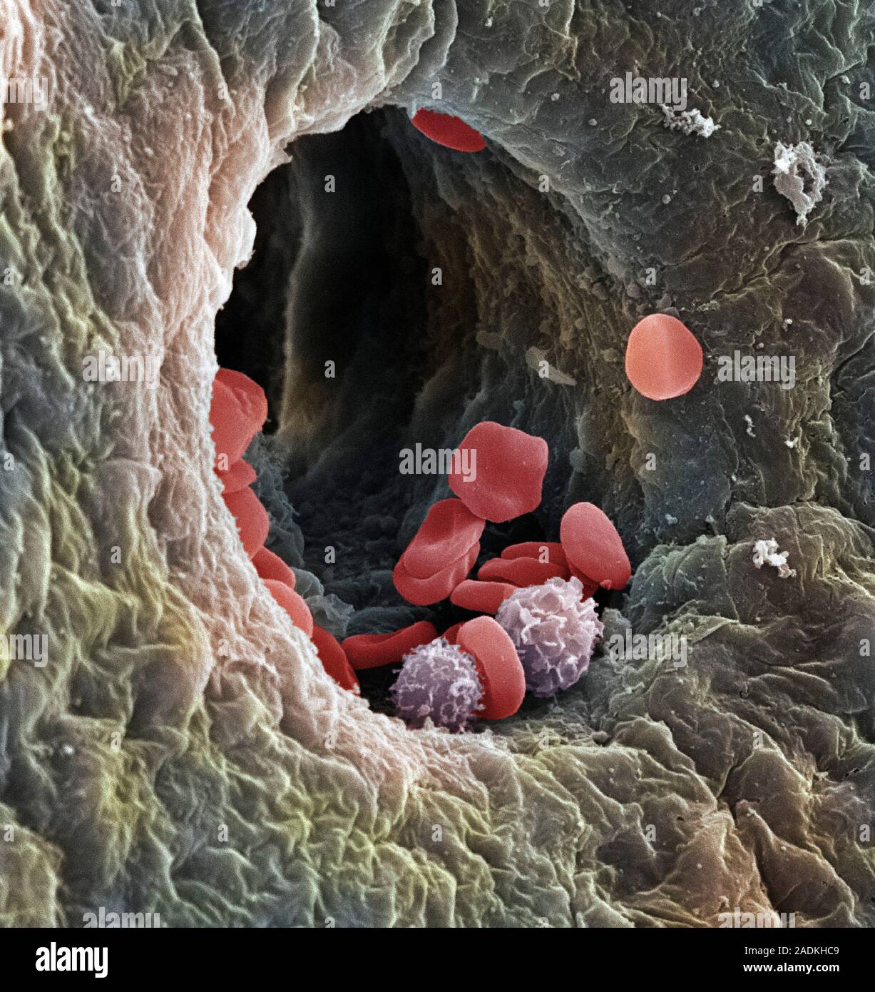 Liver capillary. Coloured scanning electron micro- graph (SEM) of a ...