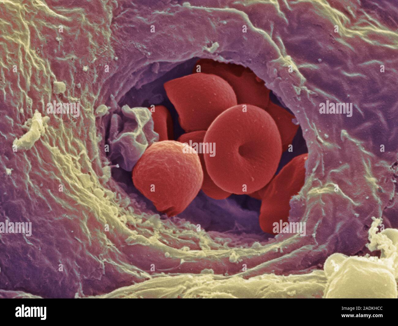 Liver capillary. Coloured scanning electron micro- graph (SEM) of a ...
