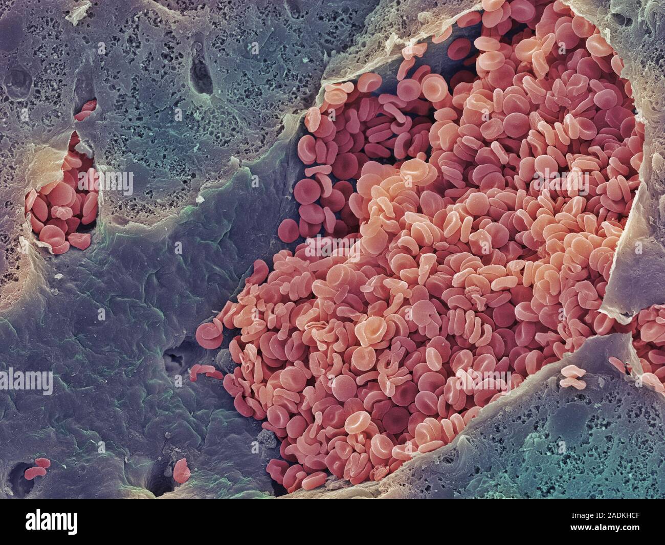 Liver vein. Coloured scanning electron micrograph (SEM) of a freeze ...