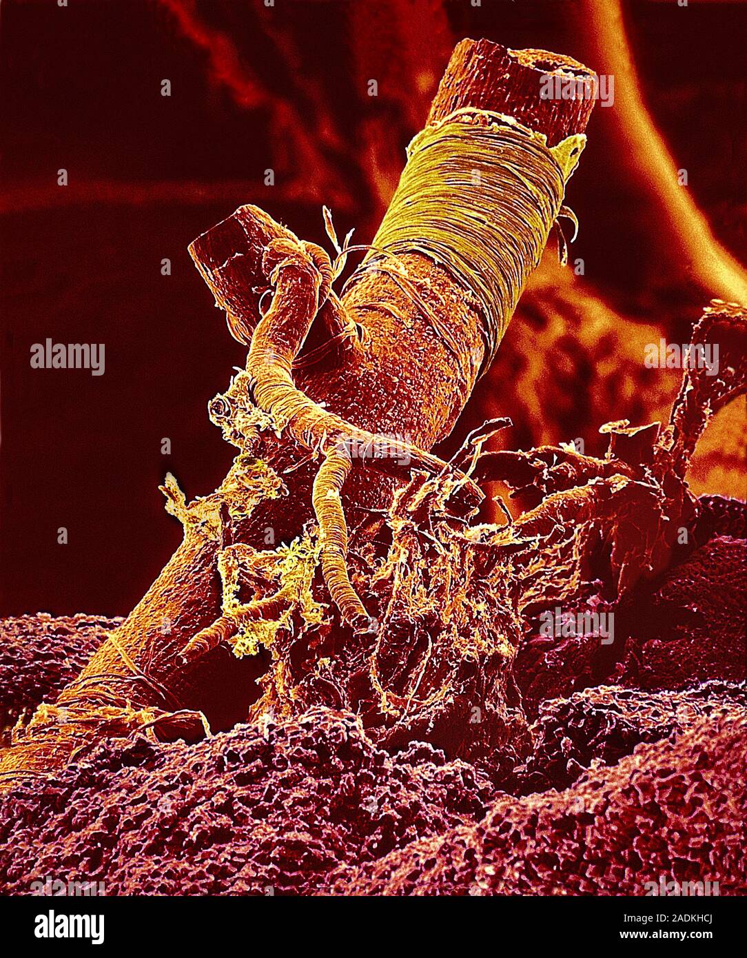 Hepatic blood vessels. Coloured scanning electron micrograph (SEM) of a ...
