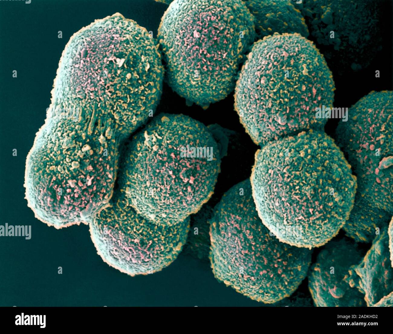 бактерии печени. темнопольная микроскопия холеры. бактерии печени. лептоспироз коров патанатомия. бактерии печени.