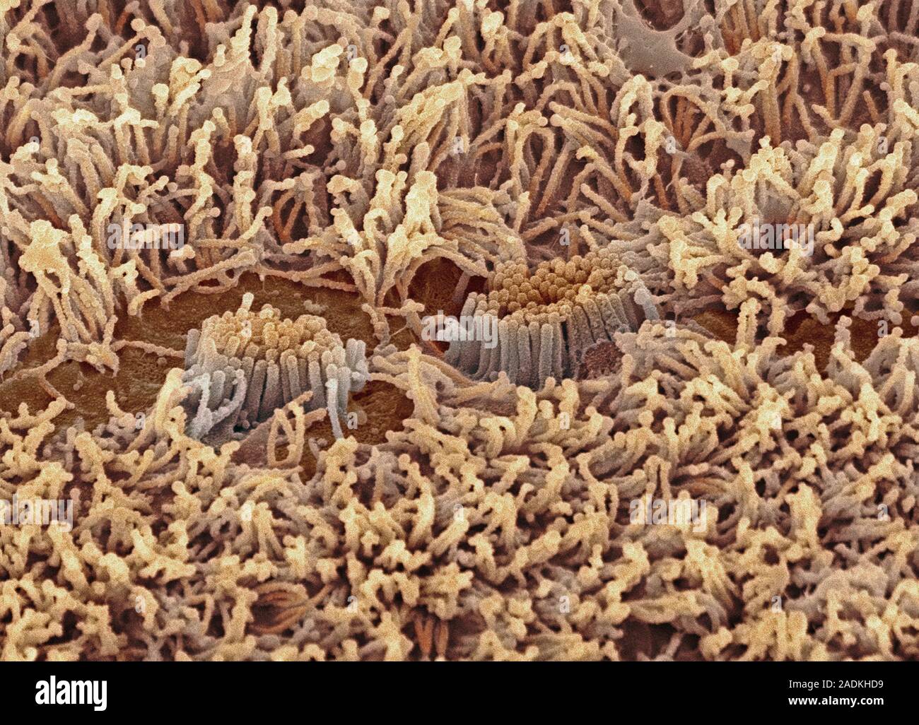 Bile duct. Coloured scanning electron micrograph (SEM) of cilia (brown