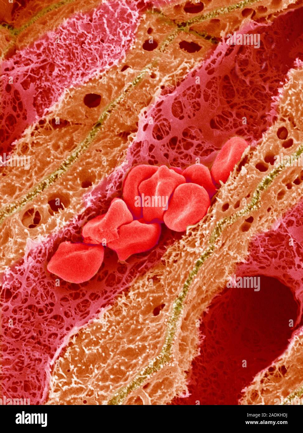 Liver blood supply. Coloured scanning electron micrograph (SEM) of ...