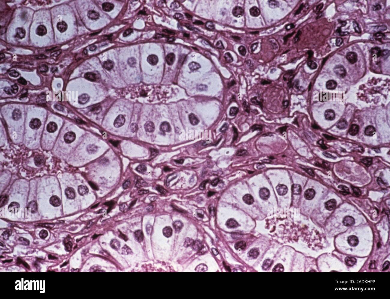 Renal collecting tubules. Light micrograph of a section through a ...