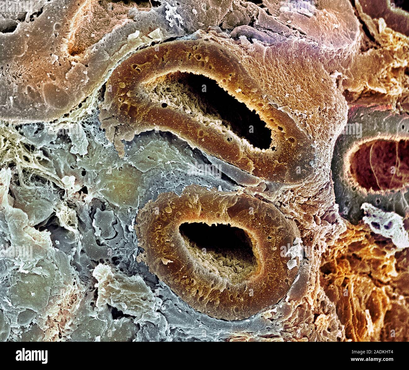 Kidney Tubules Coloured Scanning Electron Micrograph Sem Of Proximal