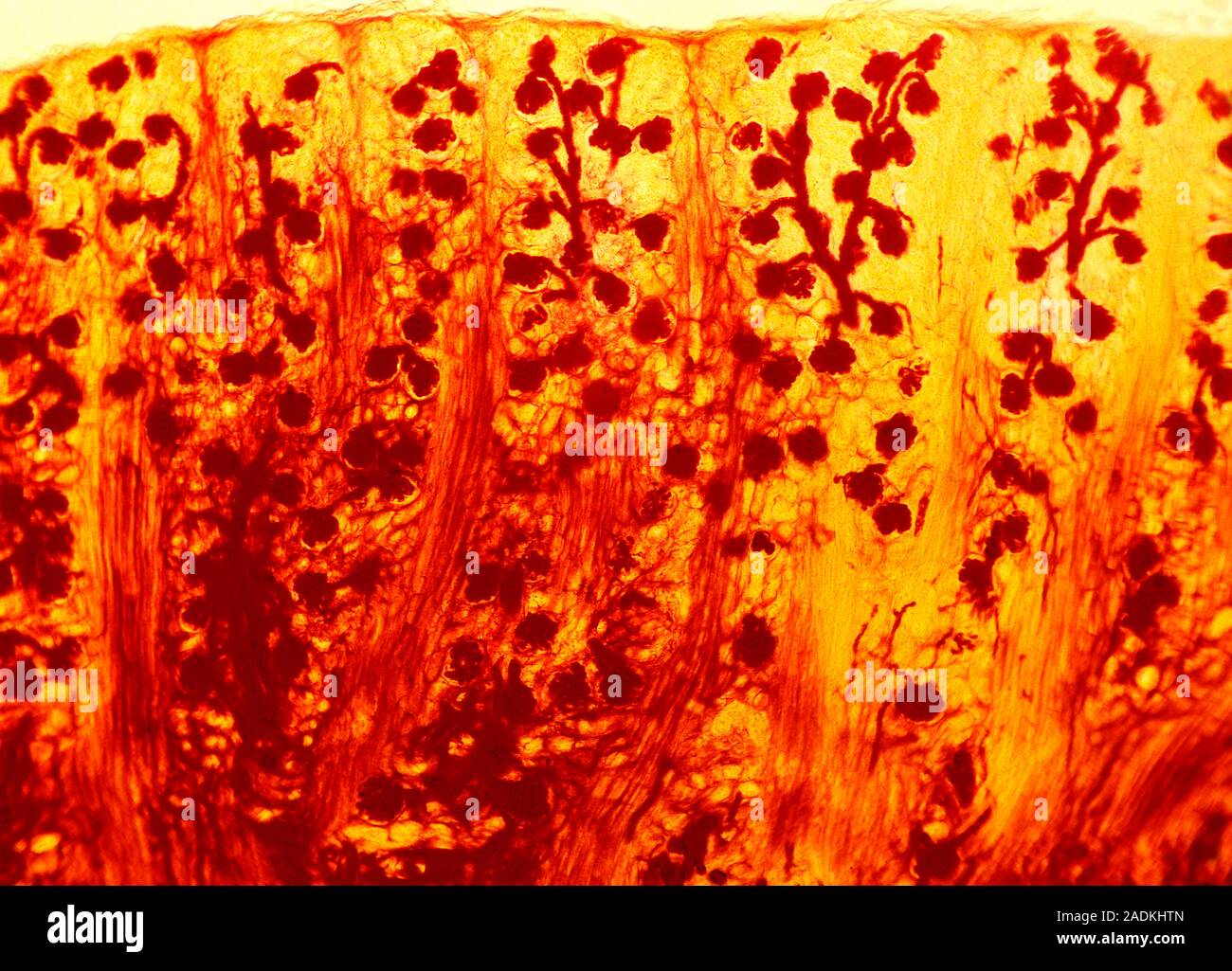 Kidney filtering units. Light micrograph of a section through a human kidney, showing the blood