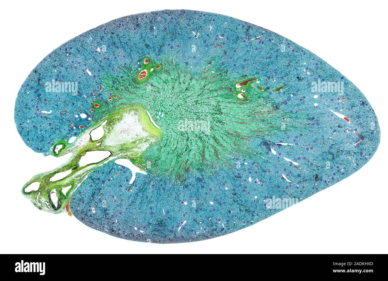 Kidney. Coloured light micrograph of a section through a kidney