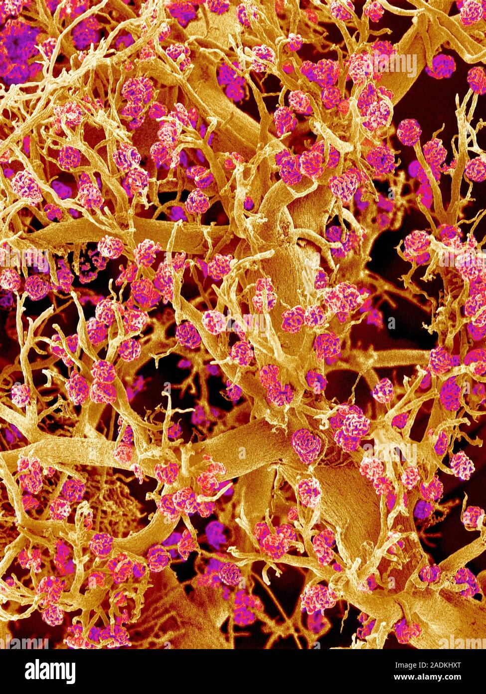 Kidney blood vessels. Coloured scanning electron micrograph (SEM) of a ...