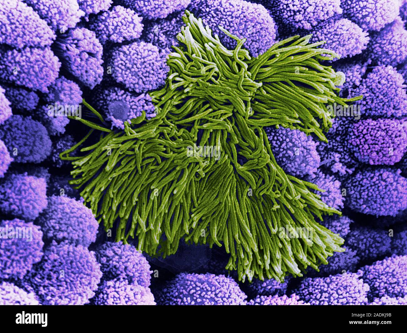 Trachea. Coloured scanning electron micrograph (SEM) of epithelial ...