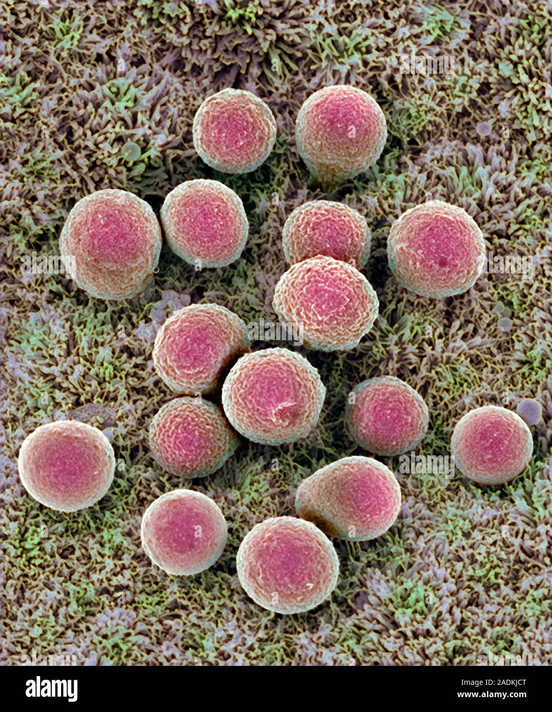 Mucus droplets. Coloured scanning electron micrograph (SEM) of droplets (red) of mucus in the
