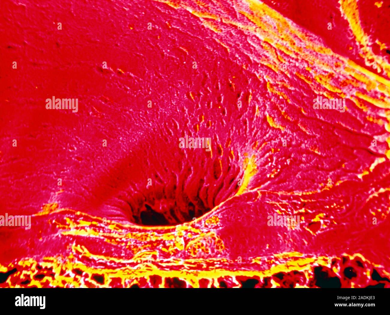 False-colour scanning electron micrograph (SEM) of a section of the ...