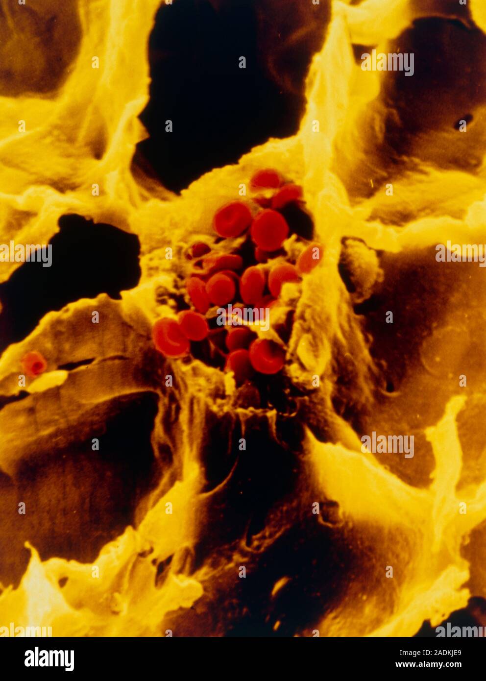 False-colour scanning electron micrograph (SEM) of a section of the ...