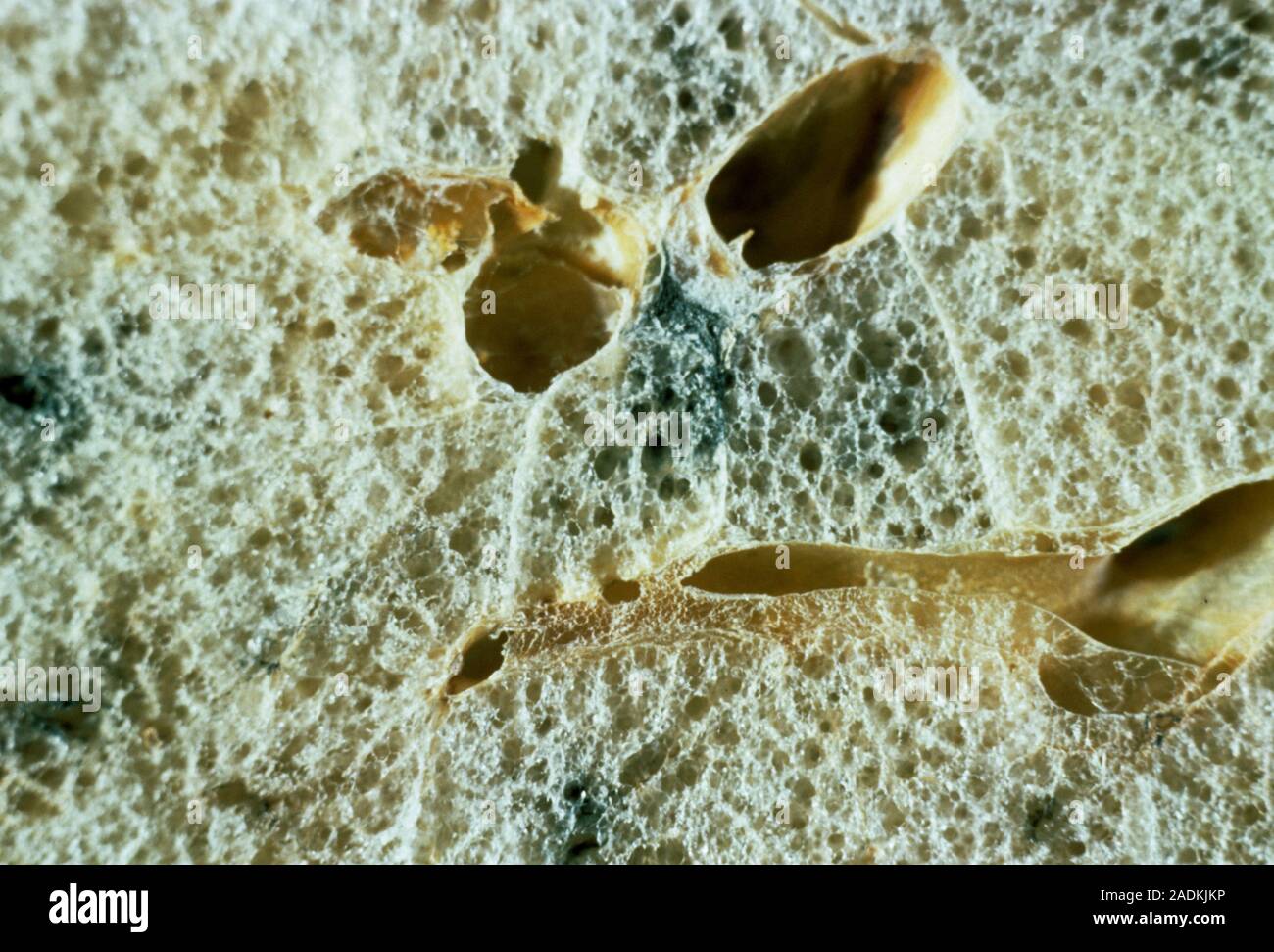 Alveoli in a sectioned lung, light micrograph. Larger airways, called