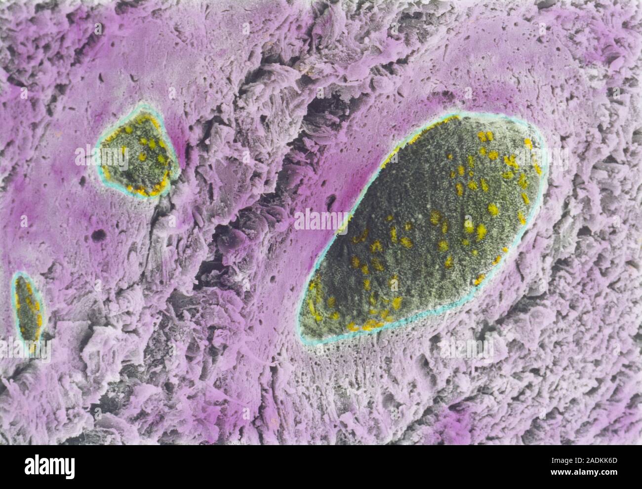 Menopausal uterine gland. Coloured scanning elect ron micrograph (SEM