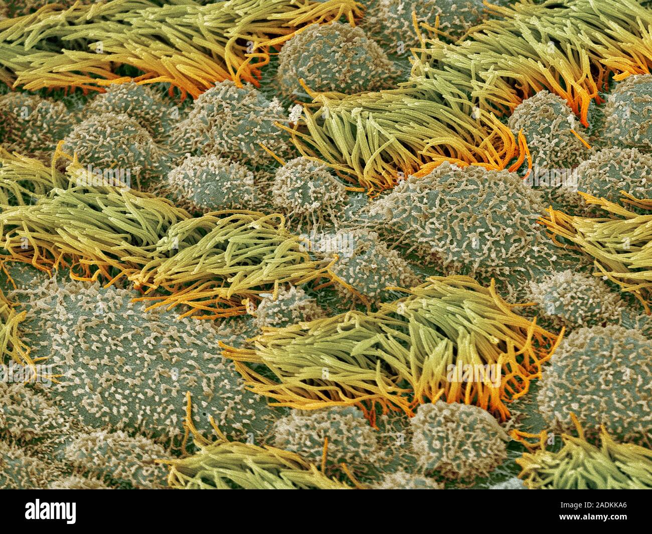 Fallopian tube. Coloured scanning electron micrograph (SEM) of the