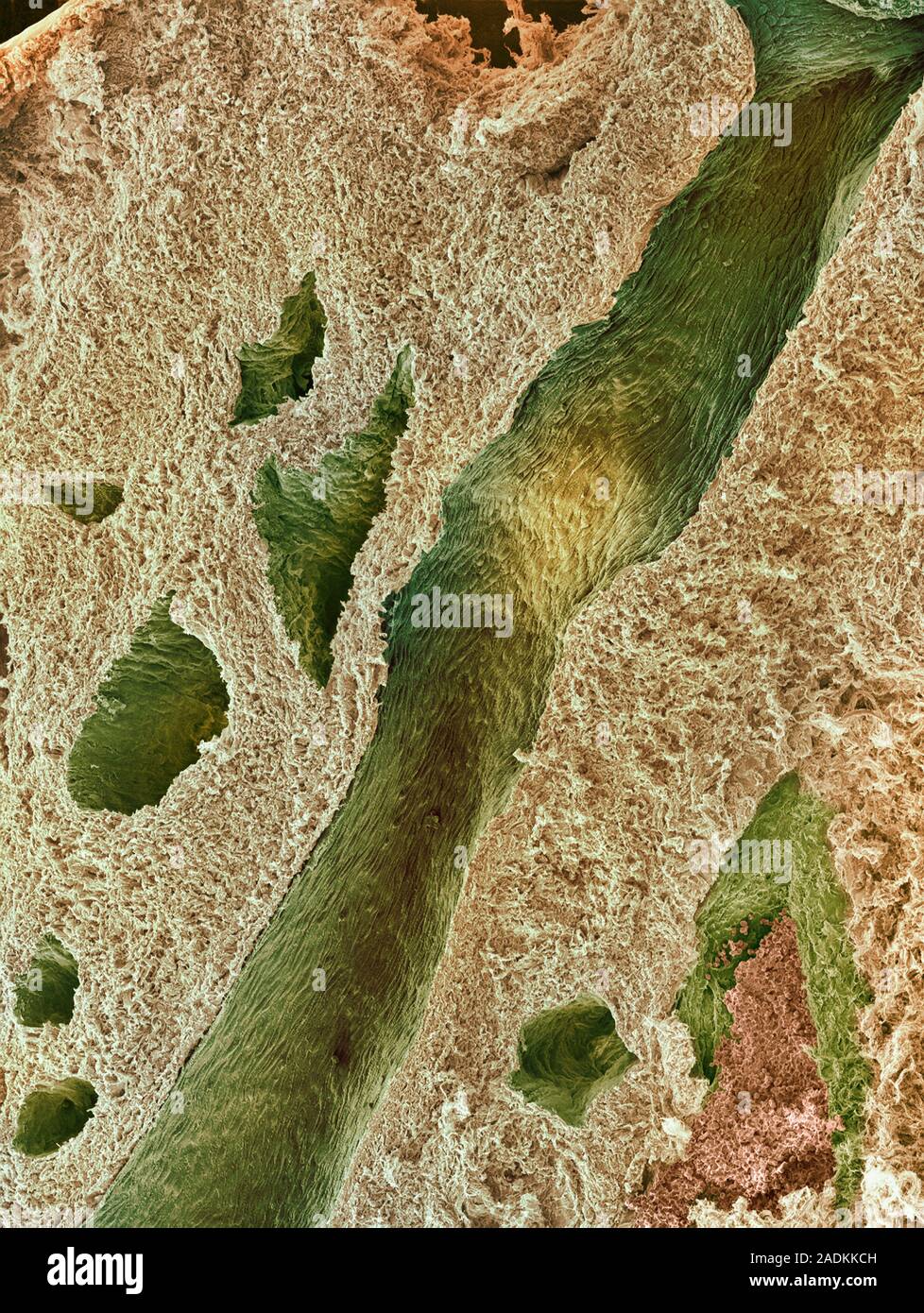 Ovarian tissue. Coloured scanning electron micrograph (SEM) of a ...