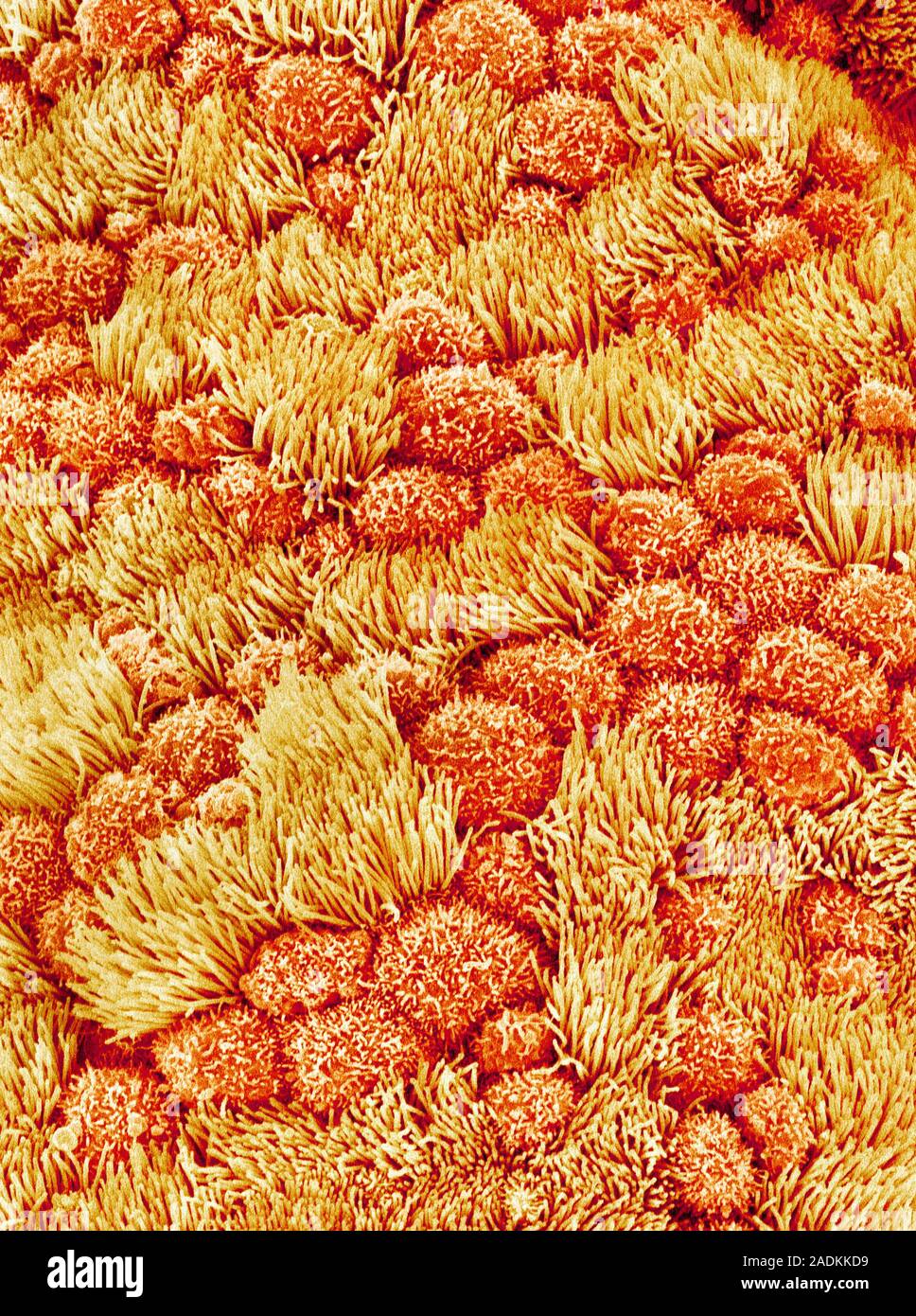 Fallopian tube. Coloured scanning electron micrograph (SEM) of the ...