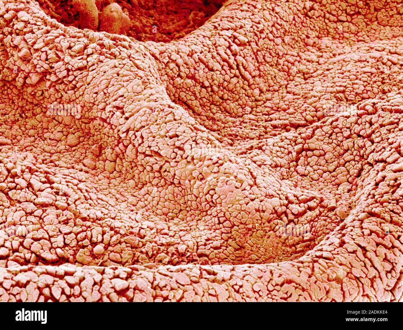 Surface of amnion. Scanning electron micrograph (SEM) of the epithelium ...