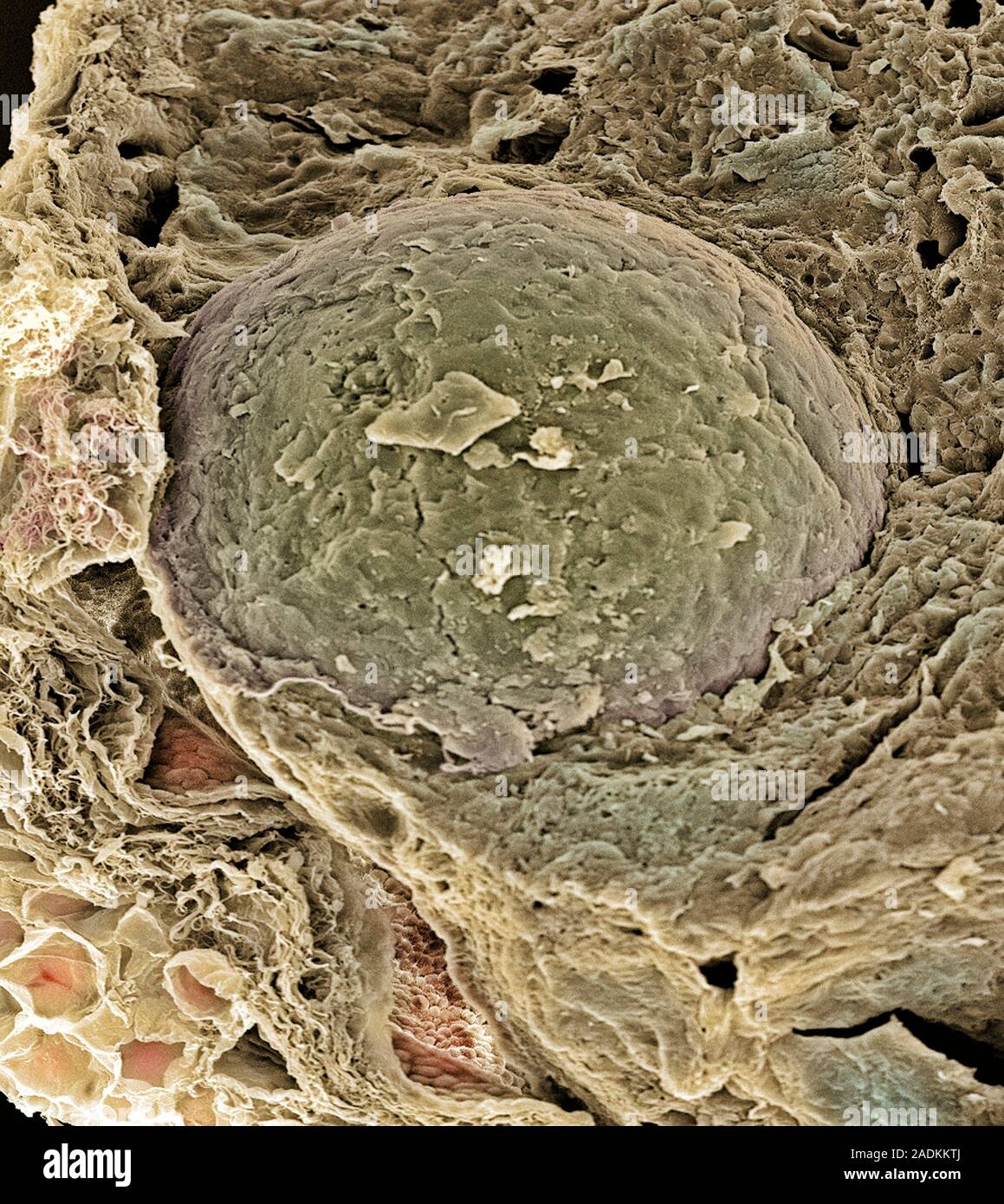 Egg cell. Coloured scanning electron micrograph (SEM) of a freeze