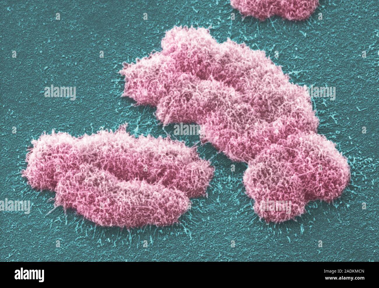 Human chromosomes. Coloured scanning electron micrograph (SEM) of two human chromosomes. Chromo