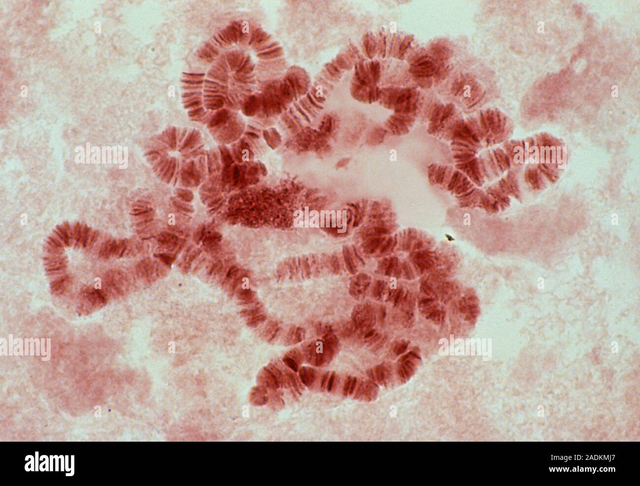 Генетика слюна. Политенные хромосомы слюнных желез личинок комаров. Препарат политенные хромосомы дрозофилы. Гигантские хромосомы дрозофилы. Политенные хромосомы слюнной железы дрозофилы.