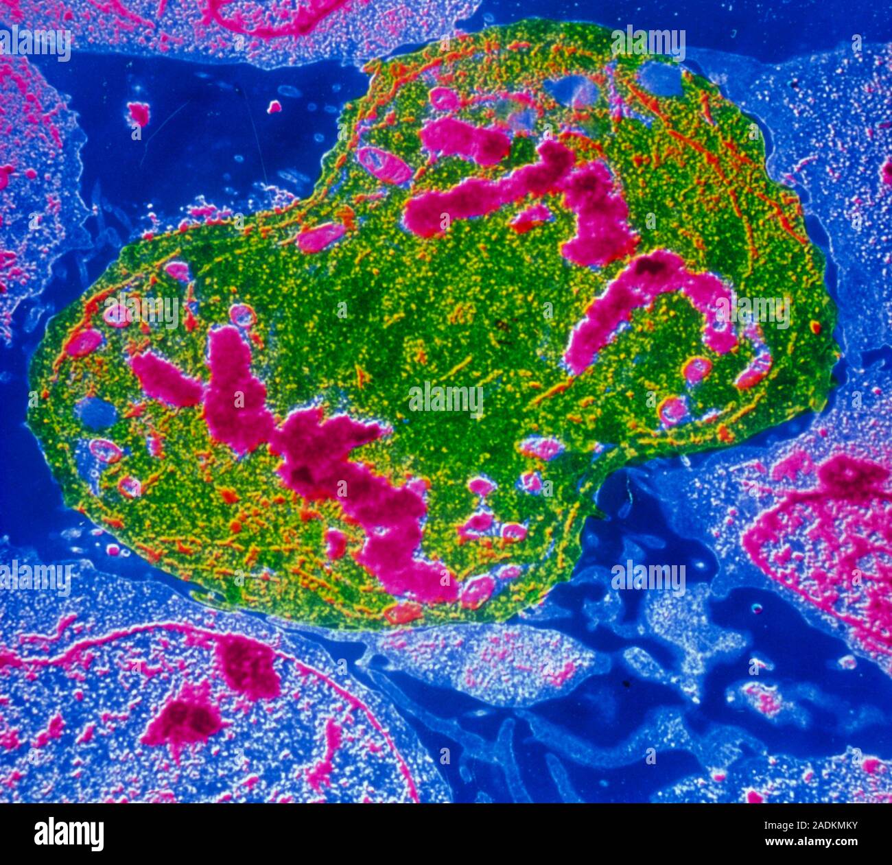 False-colour transmission electron micrograph (TEM) of a human ...