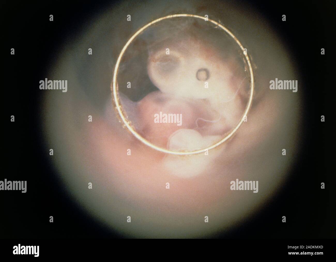 Endoscopic image of the human embryo in vivo after 4 weeks, showing the