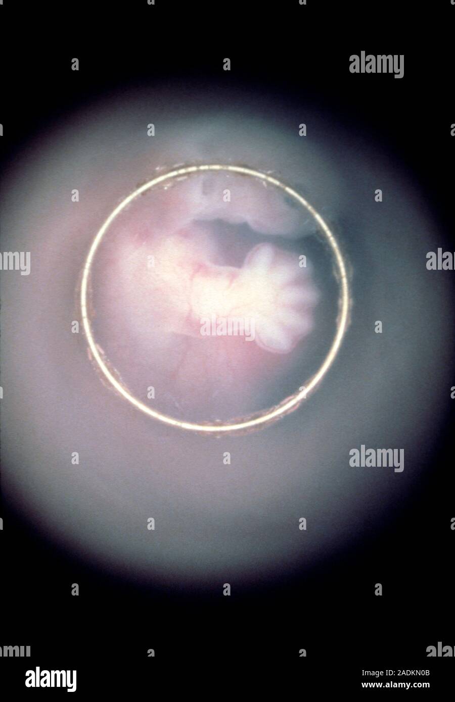 Endoscopic image of the human embryo in vivo, after 5 weeks, centred on the hand & arm, with the