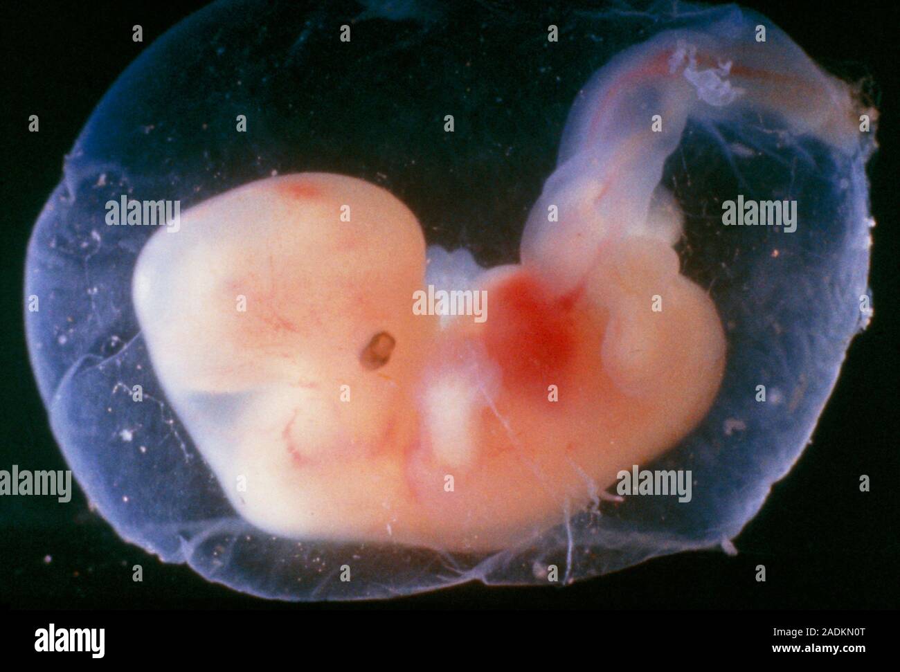 Срок плода 6 недель. Зародыг человека на 5 недели беременности. Эмбрион человека 5 недель.