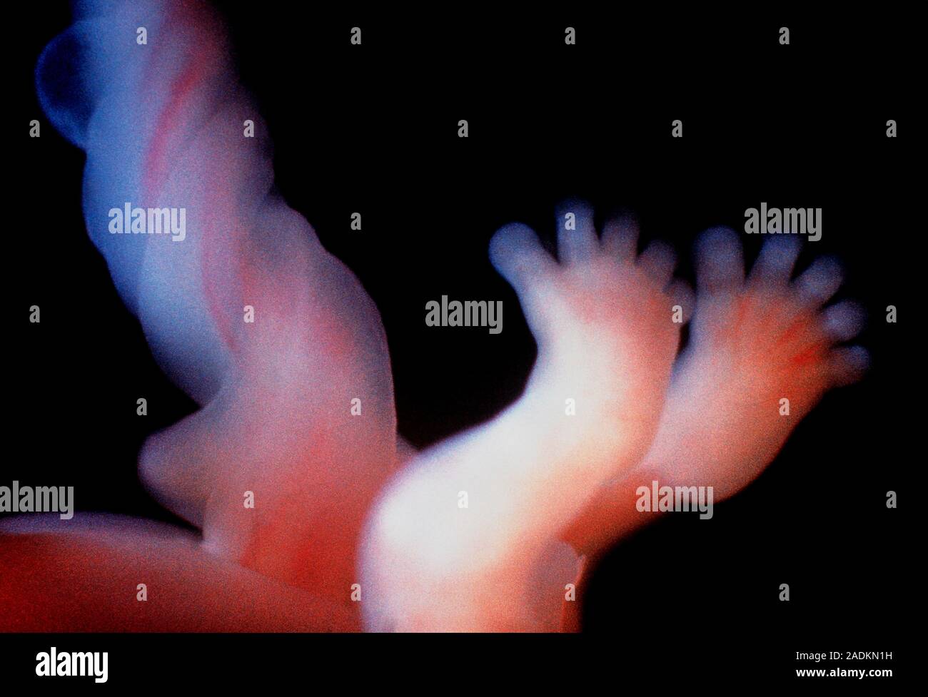 The human foetus after 10 weeks, showing the legs & feet (note