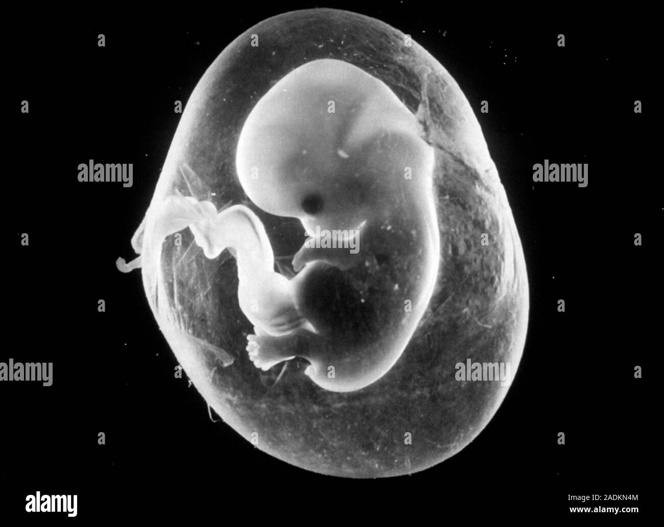 A human fetus after eight weeks development, surrounded by an intact
