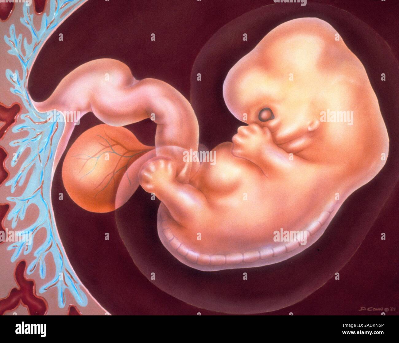 Human embryo. Illustration of a human embryo aged six weeks (42 days ...