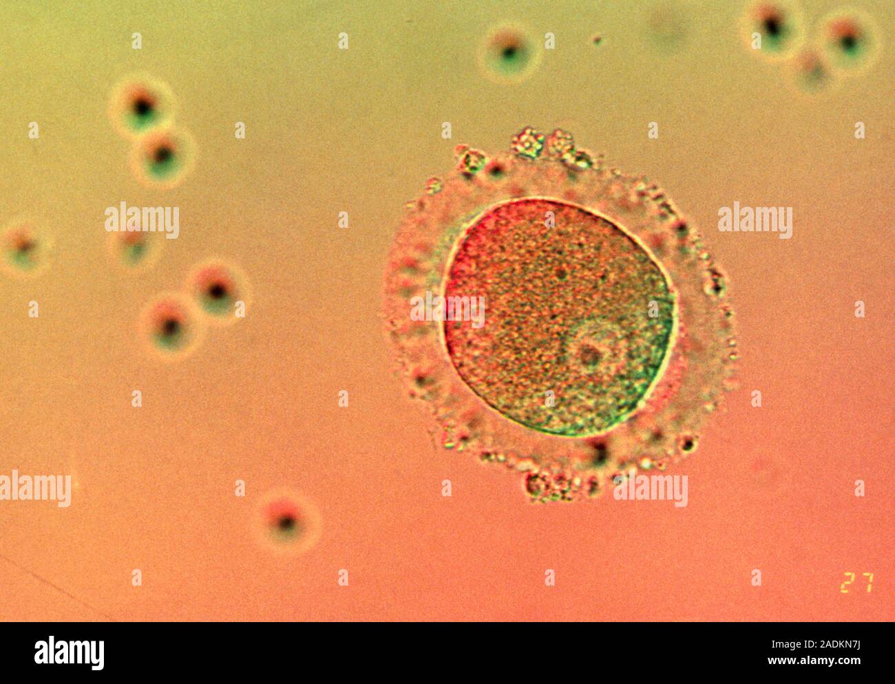 Human zygote. Light micrograph of a human zygote (the primitive embryo