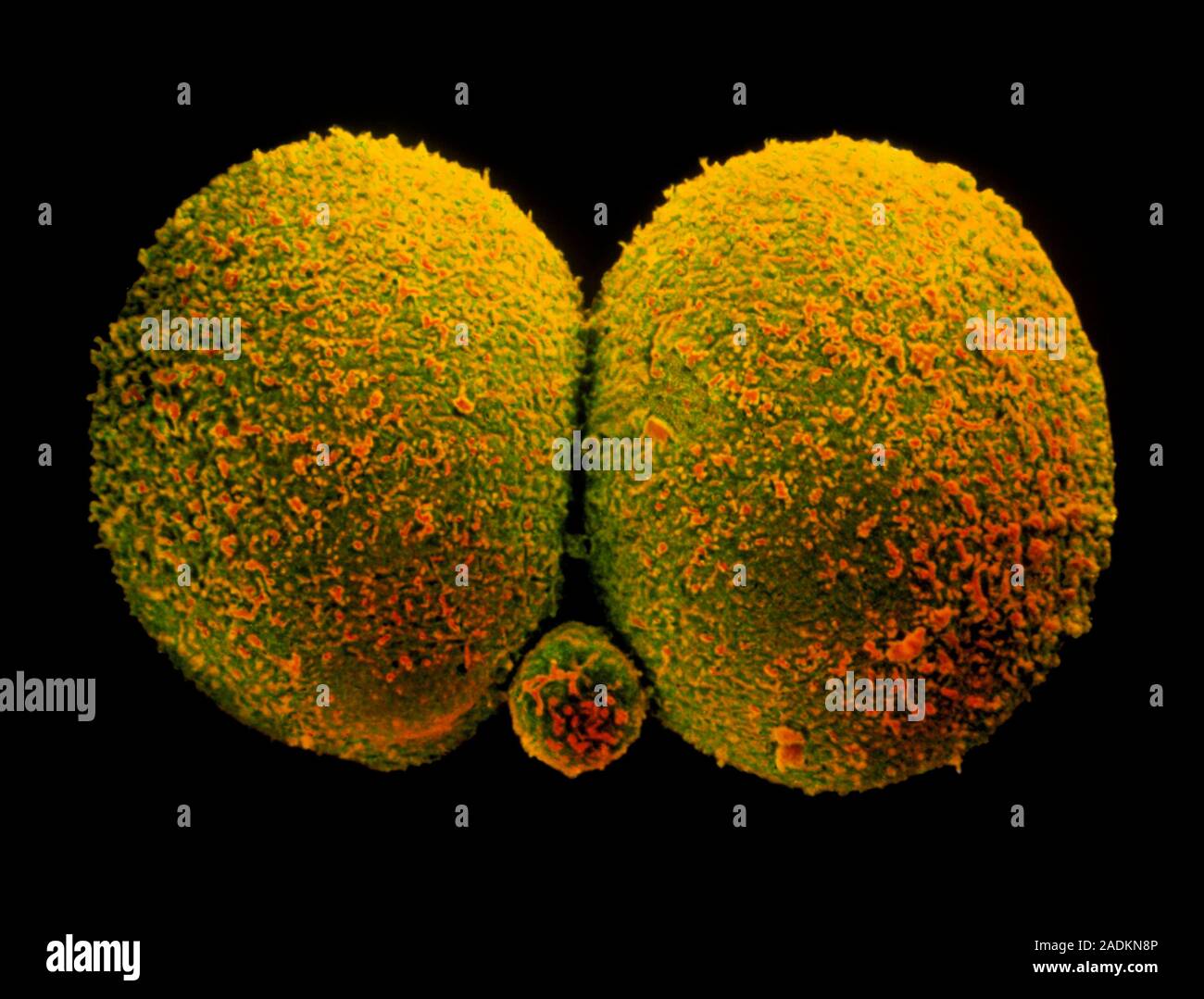 Two-cell embryo. Coloured scanning electron micrograph (SEM) of a human ...