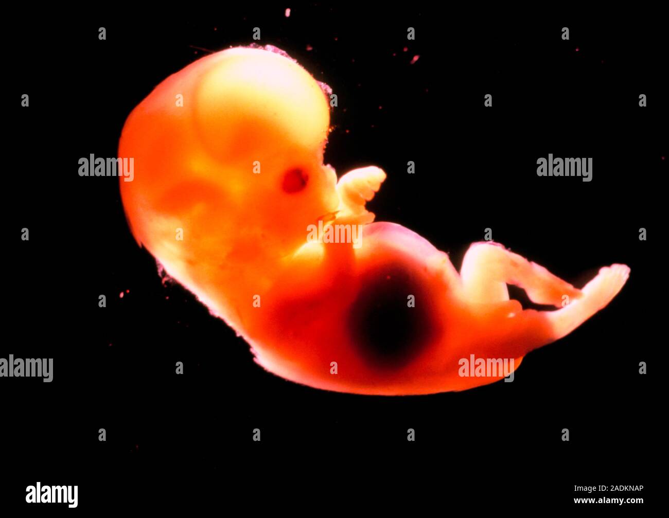 3 mois utérus foetus 12 semaines de grossesse