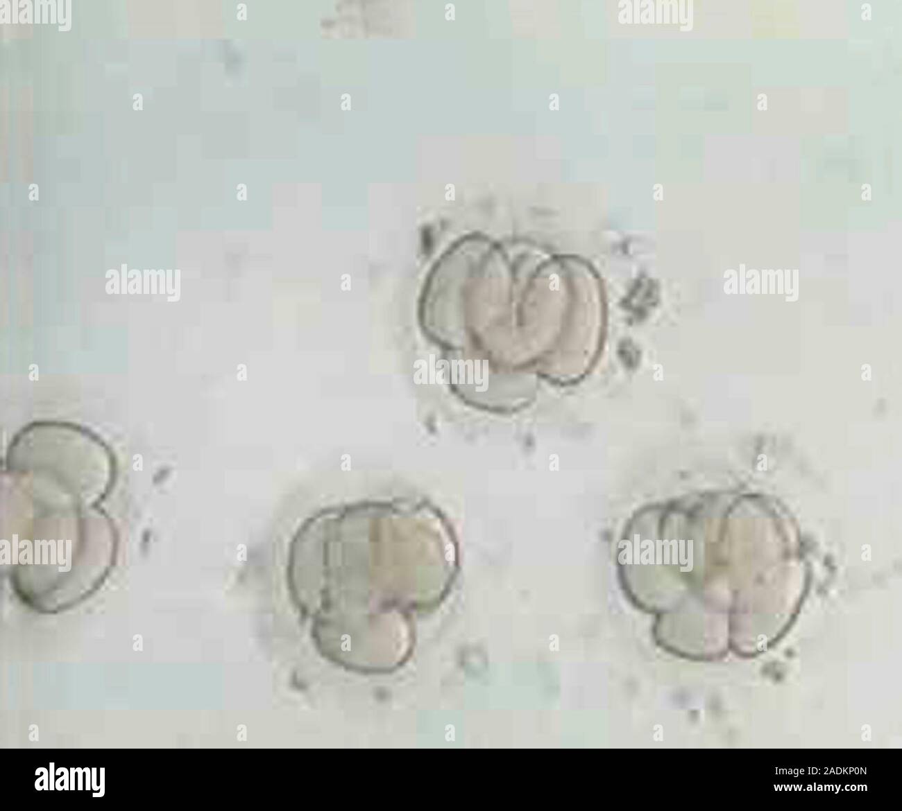 Multi-celled embryos. Light micrograph of embryos, each comprised of ...
