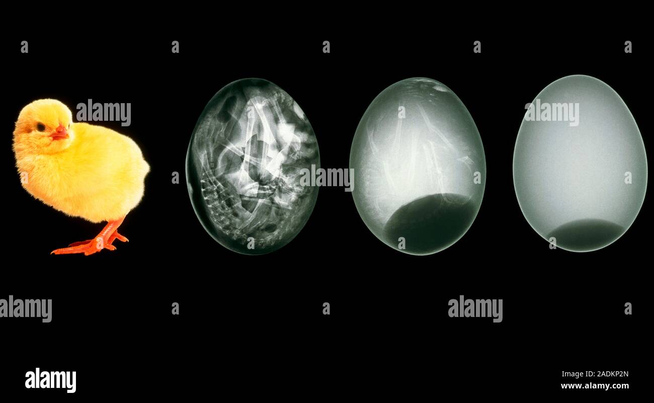 Chicken Embryo Development X rays Of The Development Of A Chicken 