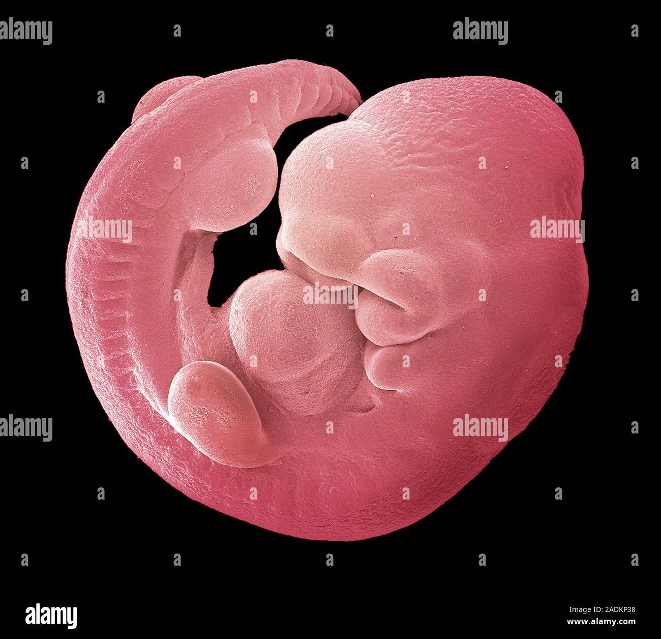 Mouse foetus. Coloured scanning electron micrograph (SEM) of a 12day