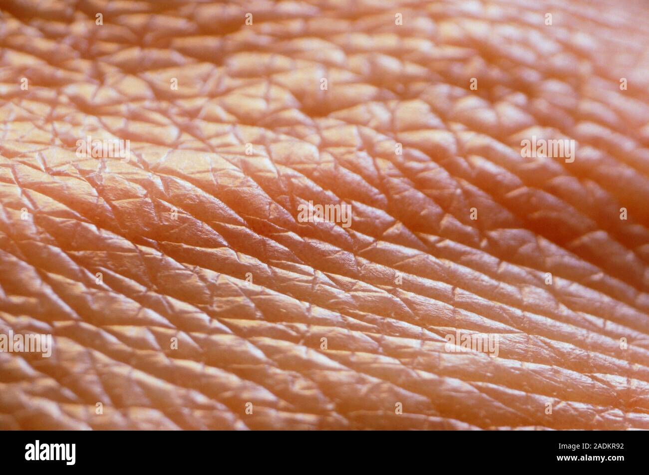 Macrophotograph of the skin on the back of the hand of a young male ...