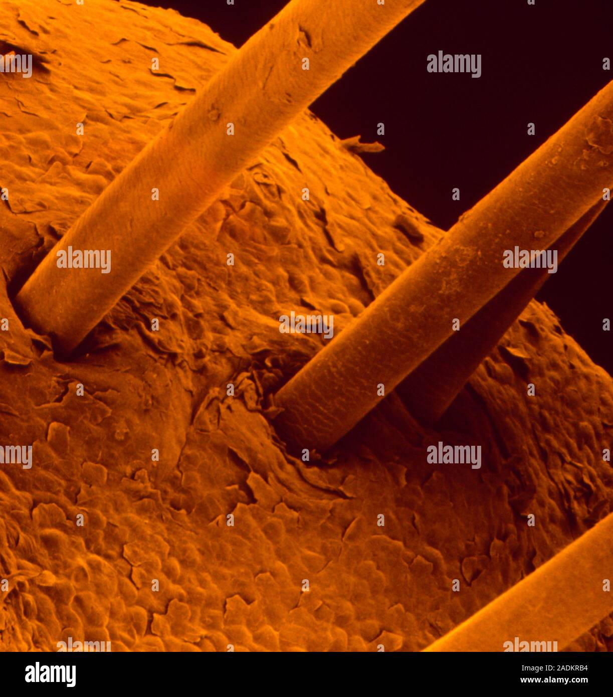 False-colour scanning electron micrograph (SEM) of the surface of human ...