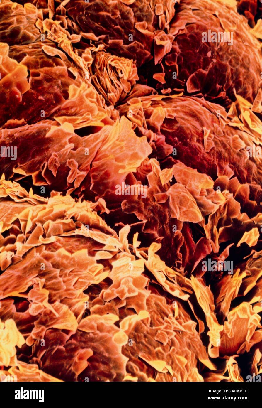 Human skin. Coloured scanning electron micrograph (SEM) of the surface of healthy human skin. The scaly appearance is due to outer cells being constan Stock Photo