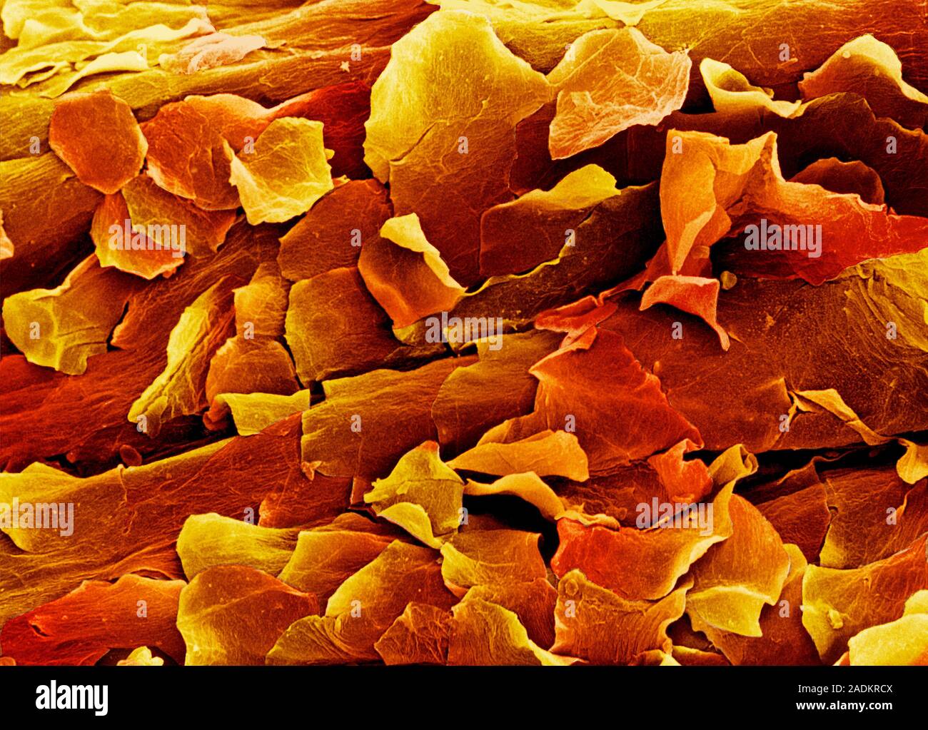 Fascia Things under a microscope, Microscope, Electron microscope