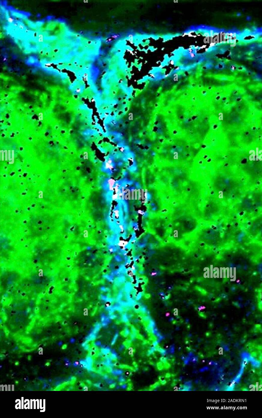 Sweat duct, fluorescence deconvolution micrograph. Fluorescent dyes ...